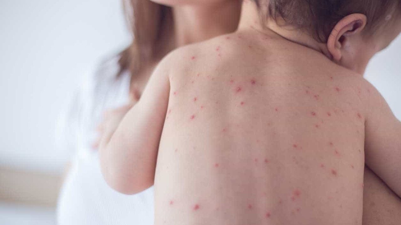 Doenças Cutâneas | Dra. Dainane Moreira | Pediatra